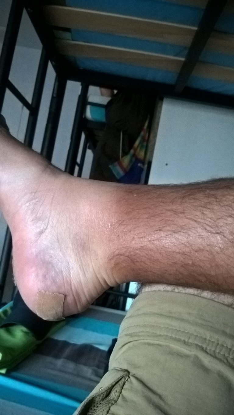 WP_20170616_15_31_58_Pro